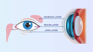 Anatomical diagram showing the structure of a dry eye and its tear film layers