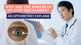 Why Are the Whites of My Eyes Discolored? An Optometrist Explains