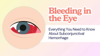 Illustration of red blood in the eye beside text on subconjunctival hemorrhage.