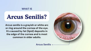 Can Colored Contacts Cover Arcus Senilis? What You Need to Know