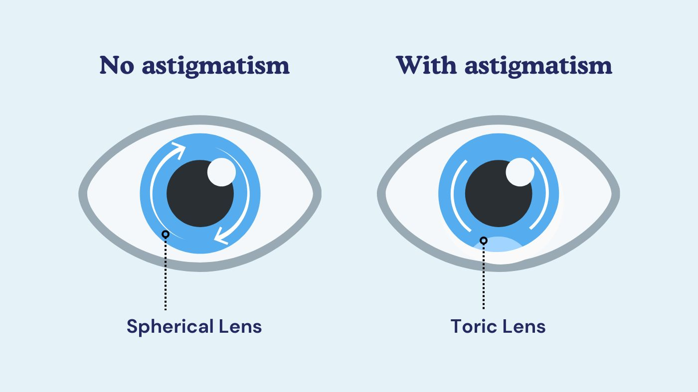 What is Astigmatism and How Do I Know If I Have It? – EyeCandys®