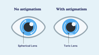 What is Astigmatism and How Do I Know If I Have It?