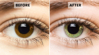Before and after comparison of an eye changing eye color from brown to light green.
